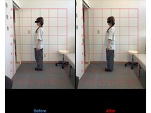 リード整骨院(LEAD整骨院)/姿勢改善、猫背、反り腰