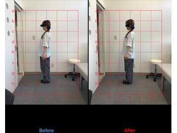 リード整骨院(LEAD整骨院)/姿勢改善、猫背、反り腰