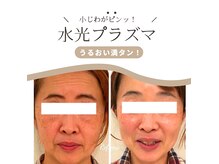 クリニカルエステ リフィーナ 西荻窪店の雰囲気（紫外線を気にせず美白してシミを薄くするならプラズマがおすすめ）