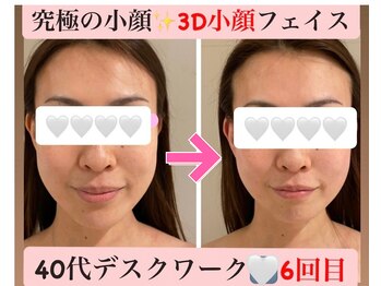 マール(Mar)の写真/【究極の小顔＆すっきりフェイスラインに】目元、口元たるみ/首肩コリまで改善！顔筋リンパ小顔フェイス♪
