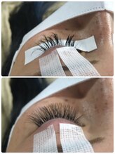 ジェリービーンズ(Jelly Beans)/劇的ビフォーアフター