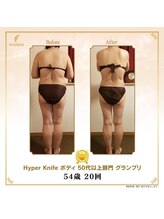 リンカ(Rinka.)/☆帯広初!!ハイパーナイフ導入☆