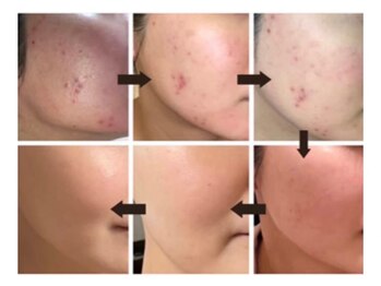 アイル 江坂店(iru)/