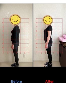 猫の目/猫背矯正　1回目終了結果