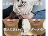 【★オーダーメイド】院長限定ailes式歪み小顔矯正￥14,300〈通常￥33,000〉