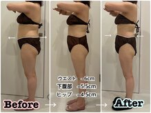 ビビ センター北店(Bibi)/ビフォーアフター