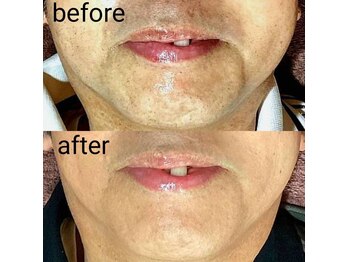 サロンドウルス(salon de ours)