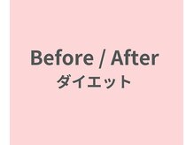トウノ オステオパシー(Tono Osteopathy)/ダイエットBefore/After