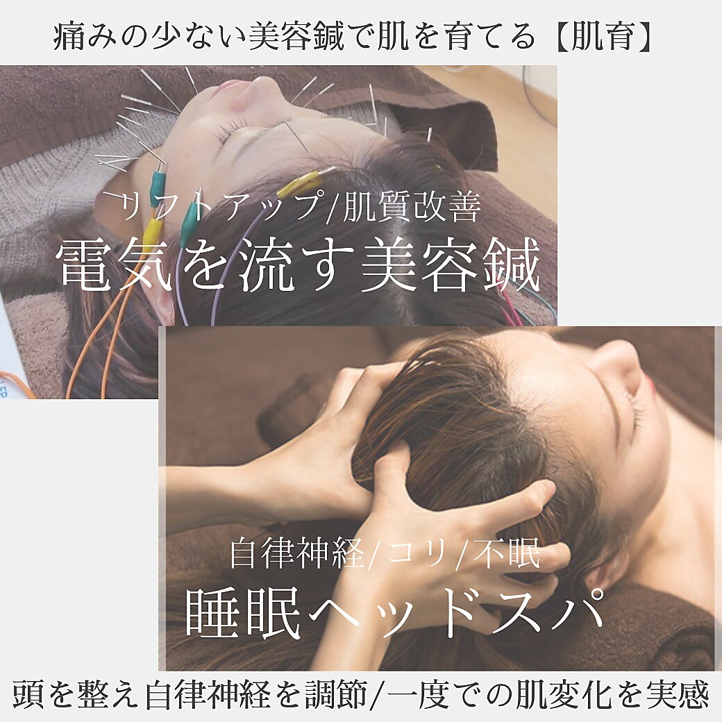 ナオ鍼灸院(Nao鍼灸院)｜ホットペッパービューティー