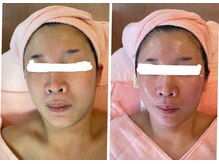 サロン ド フルール/【５０代】ビフォーアフター