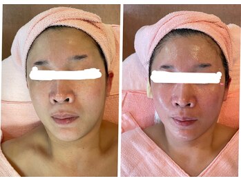 サロン ド フルール/【５０代】ビフォーアフター