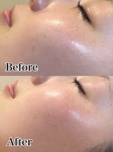 ルル 北仙台/お客様Before/After　くすみ　