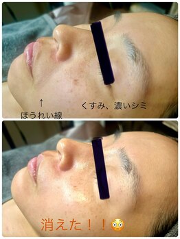 リカルム(Recalme)/30代