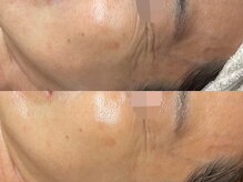 リスト(Rist TOTAL BEAUTY)/LDM