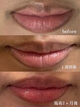 キュライム カブール町田店/長年の悩みも1回で解消！