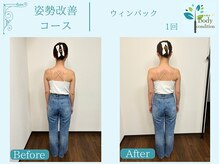 ボディコンディション/ウィンバック/痩身/小顔ラジオ波