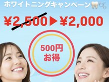 アーティ(aaty)の雰囲気（新生活応援キャンペーン☆春に向け"歯の黄ばみ"を改善！）