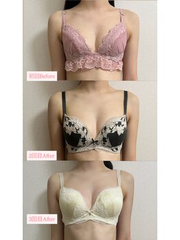 チュラ 大宮店(Chura)/【20代】バストアップ3回目@大宮