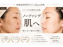 アルル 甲賀(ARuru)