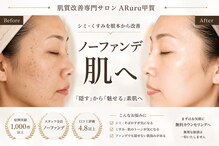 アルル 甲賀(ARuru)