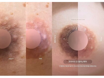 ドクターメラニンラボ トーキョー 新宿店(Dr. Melanin Labo TOKYO)の写真