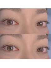 ジョリー(Jolie)/毛周期