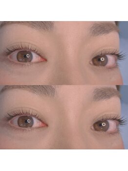 ジョリー(Jolie)/毛周期