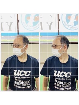 門前仲町イエティ鍼灸整骨院（旧：イエティ鍼灸整骨院）/首の痛み痺れで首が回らない方！