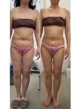 メリアミーゴ(Meli amigo)/