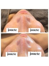 ジュエッテ(jouete)/第4世代ピーリング　ララピール