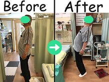 杉本接骨鍼灸院/ストレッチも教えてもらえた