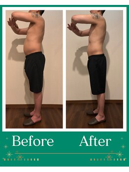 シャルマン(CHARMANT)/5回でここまで変わります！