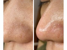 サイ(Sai)/before⇒after