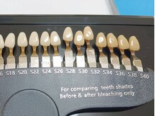 リュクネイル 拝島店(RyukuNail)/スタンダード8分4回￥5,000円