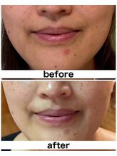 ラフルール(LA FLEUR)/よもぎ蒸し