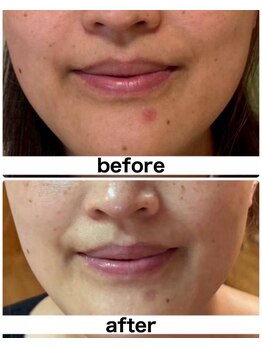 ラフルール(LA FLEUR)/よもぎ蒸し