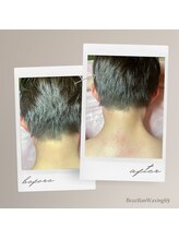 ブラジリアンワキシング シックスナイン(BrazilianWaxing69)/女性 / うなじ