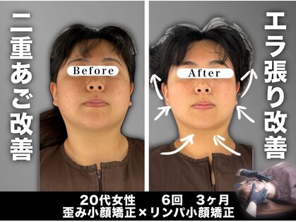 エレヴィザ トウキョウ 恵比寿院(ELVISA TOKYO)の写真