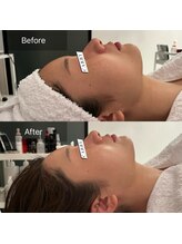 ルネアススパ 南青山(Lune’as Spa)/フェイシャル