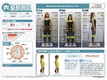 カイロプラクティックアンド姿勢ケア ミウ(MIU)/姿勢画像測定（歪みの可視化）