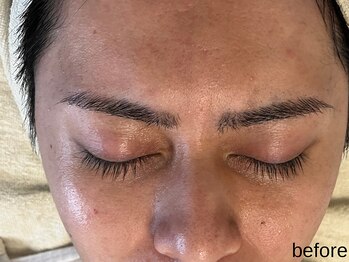 サロン ド エメ(salon de aimer)/【Before】開き毛穴、くすみに