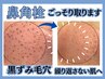 初回鼻エクストラクション＋ハイドラ＋美容液導入＋毛穴引き締めパック付9600
