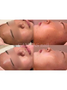 お肌をきれいにしたい