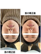 ソルビーフェイス(SOL*BeFace)/首の矯正でラインがシュッと♪