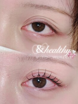 アテプラス(ate+)/アンドヘルシー