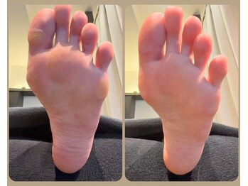 セレネス(SERENESSE)/Before and after