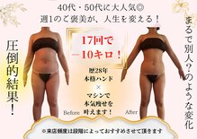 エステティックリラクゼーション フォーユー(for 悠)