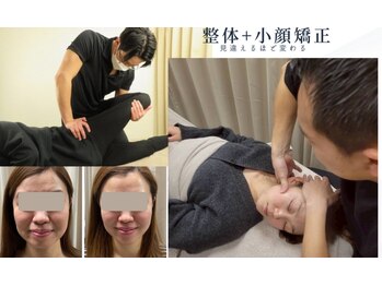 アヴァンサル 札幌駅前店(Avanzar)/完全都度払い小顔矯正