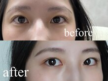 シエナ アイ(CIENA eye)/