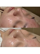 韓美(KANBI)/韓国肌管理Before After